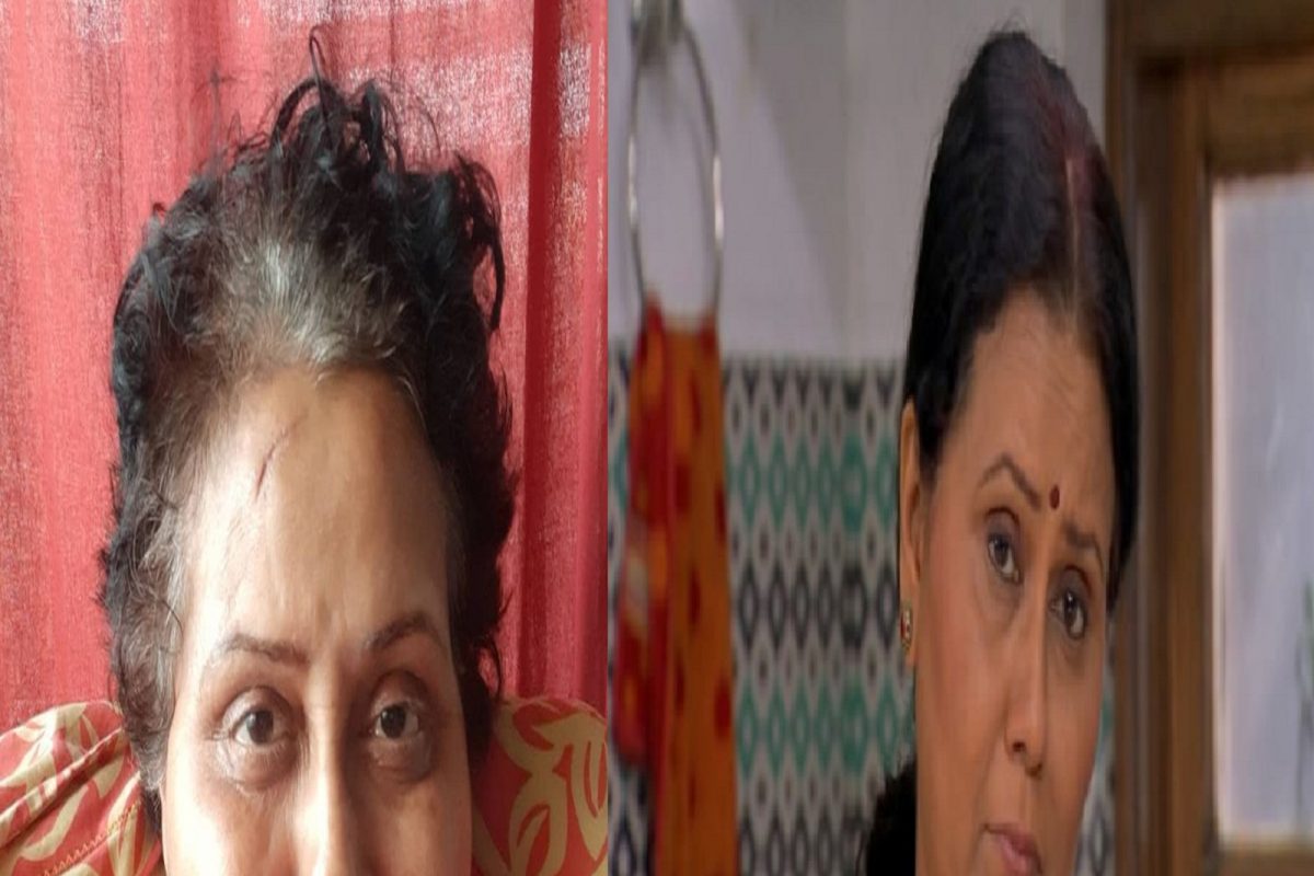 बापरे! प्रसिद्ध मराठी अभिनेत्रीची अवस्था झाली भयंकर; PHOTO शेअर करत म्हणाली, 'माझ्यासाठी प्रार्थना करा'