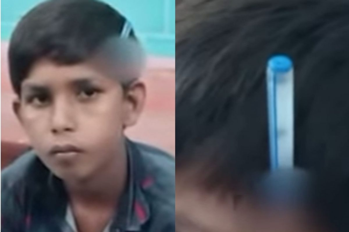 Shocking Video! खेळता खेळता झालं भांडण, छोट्या भावाने पेनच घुसवलं डोक्यात