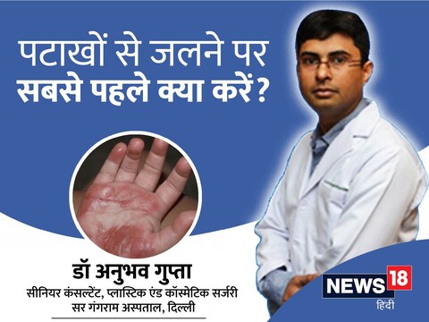 फटाक्यामुळे कोणाला भाजल्यास प्रथमोपचार कसा करावा. न्यूज 18 ग्रुपने या विषयावर दिल्लीच्या सर गंगाराम हॉस्पिटलमधील प्लास्टिक आणि कॉस्मेटिक सर्जरीचे वरिष्ठ सल्लागार डॉ. अनुभव गुप्ता यांच्याशी (First Aid For Burns By Diwali Firecrackers, Sehat Ki Baat) चर्चा केली.