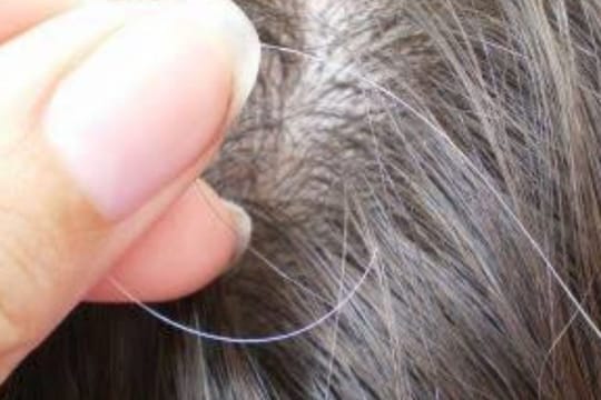 White Hair