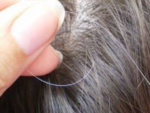 White Hair
