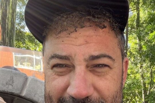 Shocking! मुलीसाठी जेवण बनवताना डोक्याला अन् भुवयांना लागली आग; पाहा पुढे काय झालं