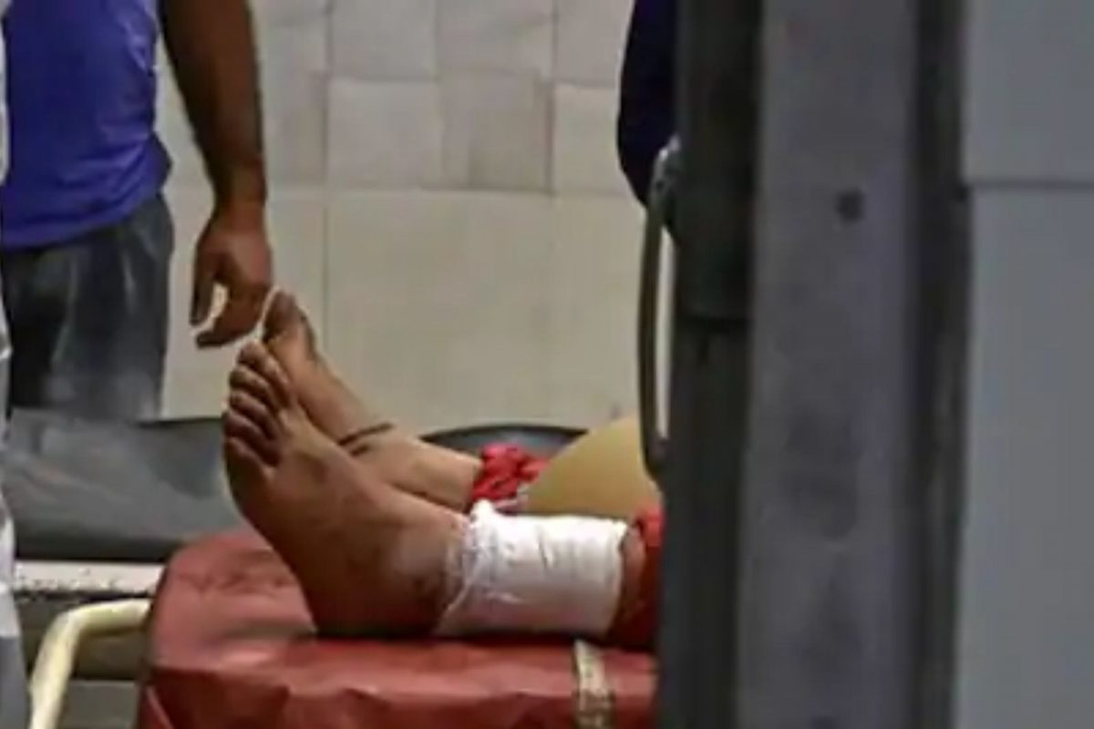 बाईकच्या हँडलमुळे तरुणीच्या प्रायव्हेट पार्टला जबर मार; मेडिकल जर्नलमध्ये केस दाखल