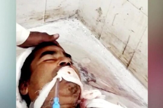 एका मागून एक 3 रुग्णालयाने मृत केलं घोषित; पोस्टमार्टमपूर्वी शवगृहात श्वास झाला सुरू