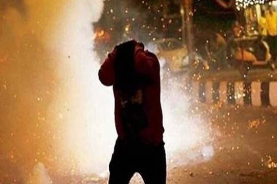 आज सकाळी विशाल सुद्धा आपल्या मित्रांसोबत फटाके फोडत होता त्यावेळी एक फटाका फुटला आणि...