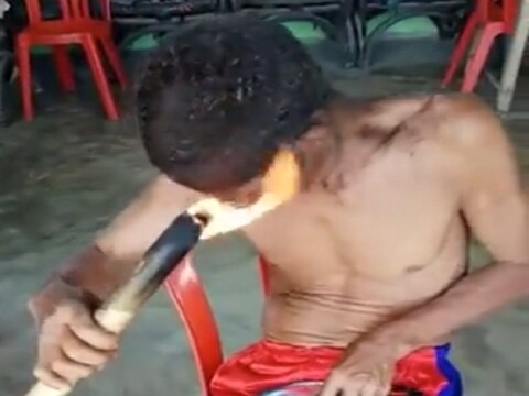 हातात जळतं लाकूड घेऊन हेअर स्टाईल करायला गेला आणि...
