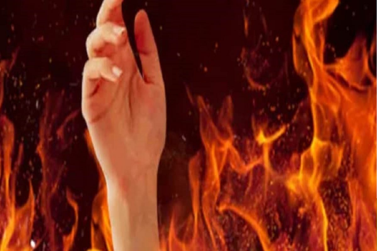 Representative Image