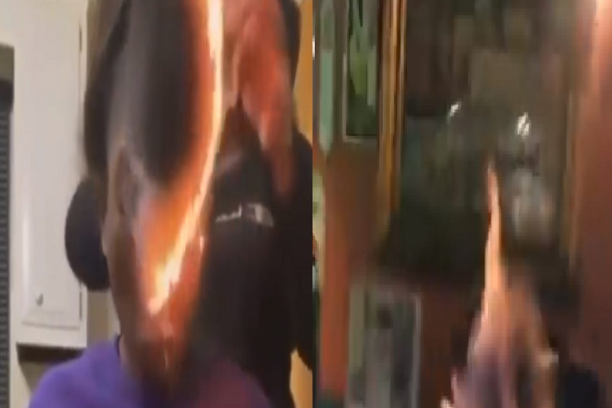 Shocking Video! Smoking करताना अख्खा चेहराच पेटला; ऐटीत धूर सोडण्याची हौस पडली महागात