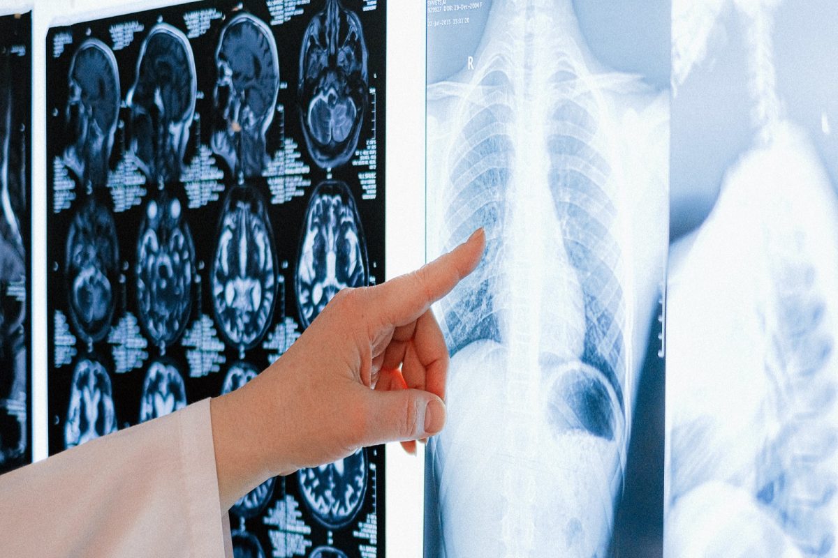 Harmful Food for Lung : फुफ्फुसांच्या आरोग्यासाठी घातक आहेत या 5 गोष्टी; नंतर वेळ जाईल निघून