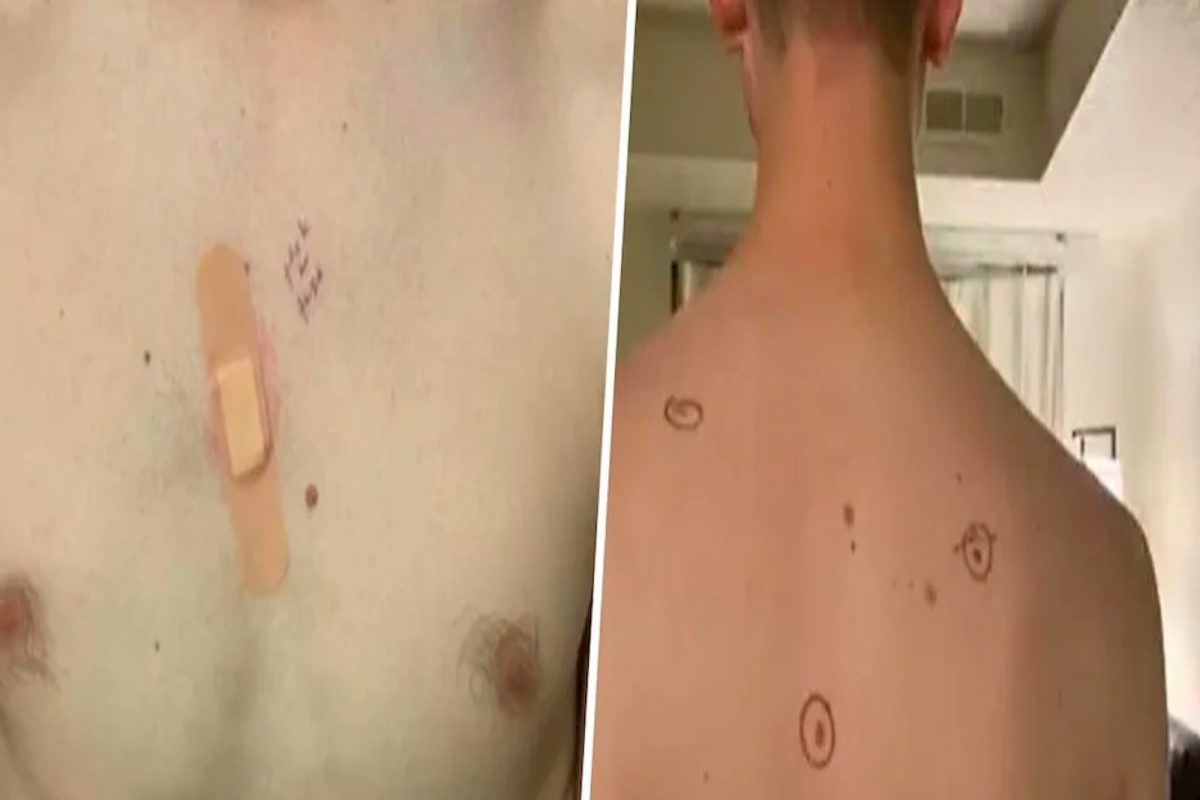 शेरास सव्वाशेर! पतीच्या तिळांवर पत्नीनं केल्या खुणा, डॉक्टरांनी त्यावरच लिहिले Remarks