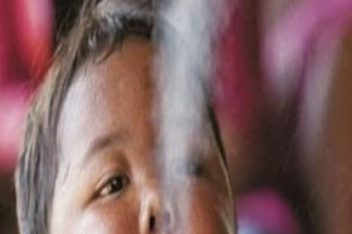 2 वर्षांचं बाळ रोज ओढायचं 40 सिगरेट, आता ओळखणंही झालंय कठीण