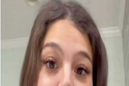 महिलेच्या नाकावर आहे विचित्र जन्मखूण, करावा लागतो ट्रोलिंगचा सामना