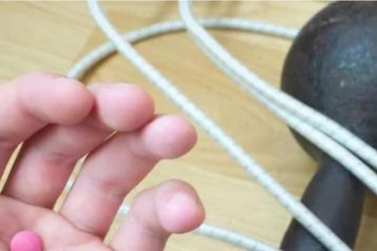 ही गोळी खाऊन मिळणार व्यायामाइतकेच फायदे; चांगल्या आरोग्यासाठी शास्त्रज्ञांनी शोधला अनोखा मार्ग