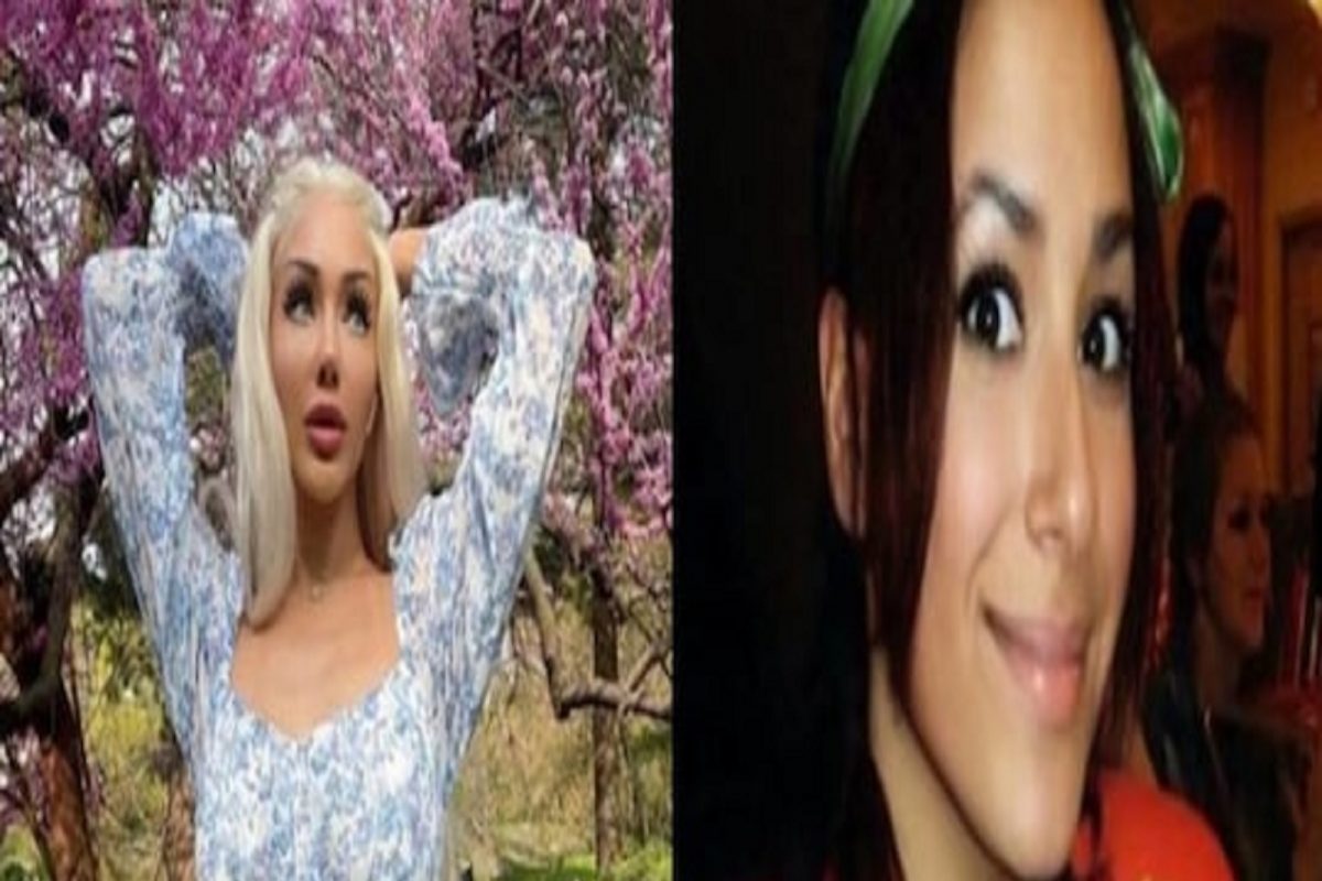 काय म्हणावं हिला! सुंदर दिसण्याच्या नादात उधळले तब्बल 10 लाख; तरुणीने चेहऱ्याची अक्षरश: लावली वाट