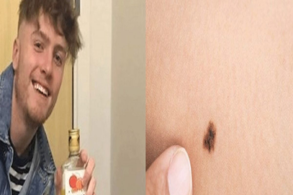 एक तीळ ठरला जीवघेणा, 20 वर्षांच्या तरुणाचा करुण अंत