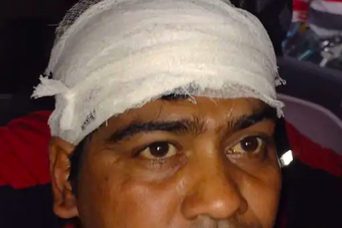 दारु पिता पिता मित्रानेच झाडली गोळी, उपचारांसाठी राहिला तडफडत