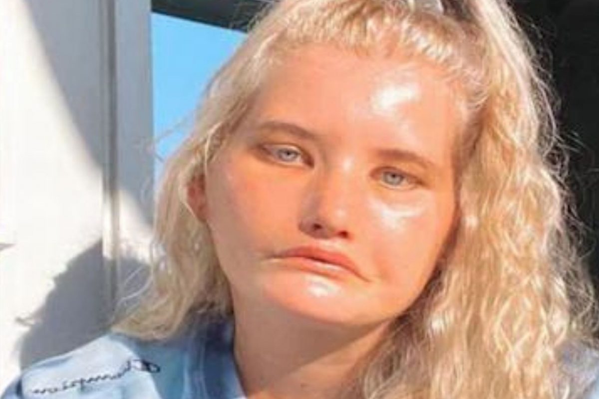 जन्मापासूनच एकदाही हसली नाही ही 24 वर्षीय तरुणी; कारण जाणून व्हाल शॉक