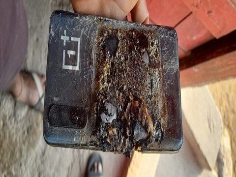 OnePlus कंपनीच्या मोबाइलचा खिशात स्फोट; तरुणाच्या मांडीला दुखापत, सांगलीत एकच खळबळ