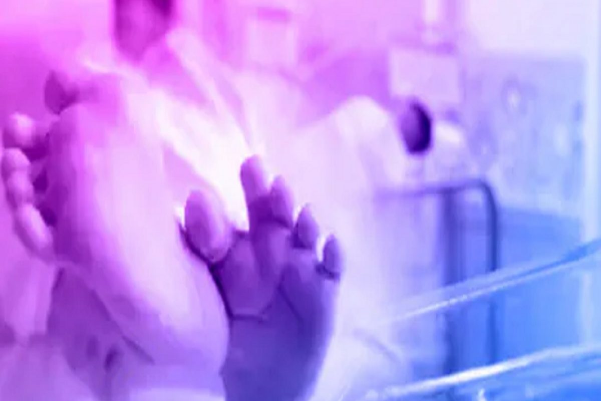 आश्चर्य! 4 हात आणि 4 पाय; भारतात जन्माला आलं असं विचित्र बाळ; डॉक्टर म्हणाले...