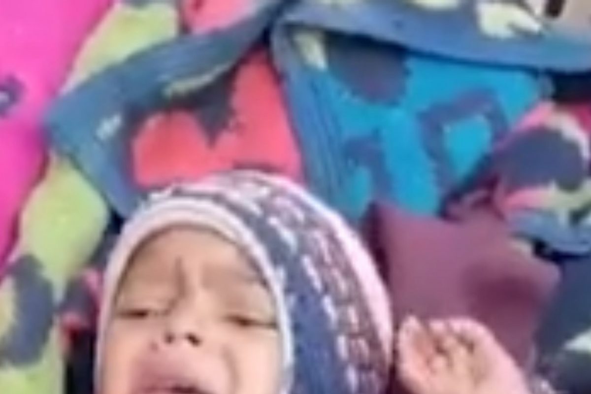 खेळता खेळता उकळतं पाणी पडलं अंगावर; उपचाराशिवाय 3 दिवस घरातच तडफडत राहिली 2 वर्षांची स्वास्ती