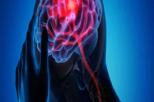 मेंदूच्या पेशींचं विषाणूमुळे झालेलं नुकसान रोगप्रतिकारक शक्तीवरदेखील परिणाम करू शकतं आणि गंभीर संसर्गाचा धोका वाढू शकतो.