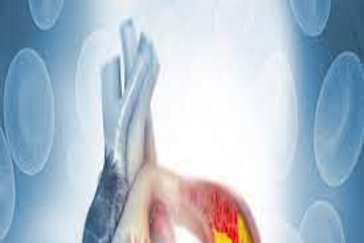 कोलेस्टेरॉलचा धोका वाढतो -
घरगुती लोणचेच आणि तेही मर्यादित प्रमाणात खाण्याचा प्रयत्न करा. कारण, बाजारात मिळणारे लोणचे तयार केले जाते तेव्हा ते चवदार बनवण्यासाठी त्यात जास्त तेल आणि जास्त मसाले वापरले जातात, जे आपल्या आरोग्यासाठी चांगले नाही. त्याचे साईड इफेक्टही होऊ लागतात. लोणच्यामध्ये तेलाचे प्रमाण जास्त असल्याने आणि त्यात वापरल्या जाणाऱ्या मसाल्यांमुळे कोलेस्ट्रॉल आणि इतर शारीरिक समस्या उद्भवू शकतात.
(सूचना : येथे दिलेली माहिती सामान्य वैद्यकीय माहितीवर आधारित आहे. न्यूज 18 लोकमत त्याची हमी देत नाही.)