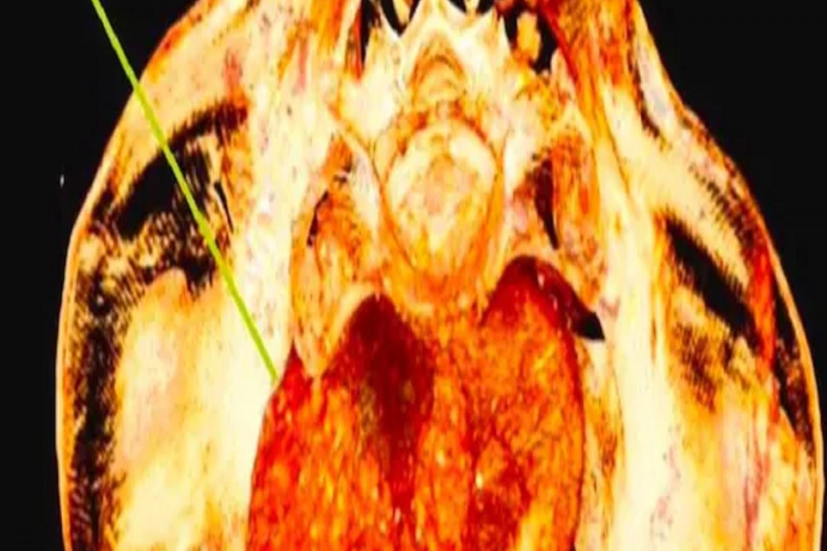 फोटो सौजन्य - Journal of Archaeological Science