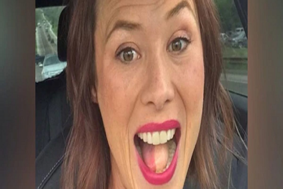 Shocking! ...अन् जिभेवरच उगवू लागले केस; विचित्र समस्येमुळे हैराण झाली महिला