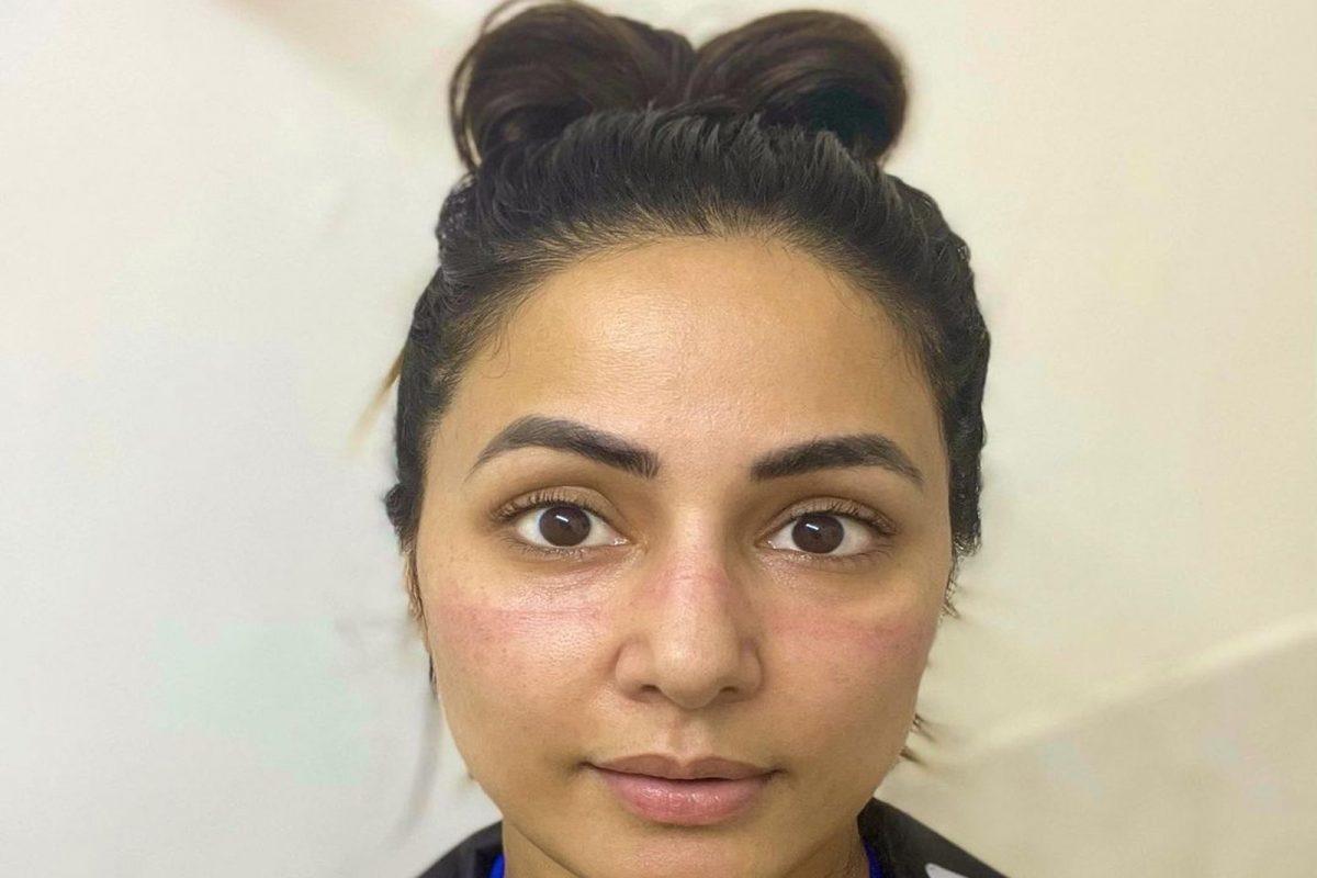 हिना खानचं संपूर्ण कुटुंब कोरोना पॉझिटिव्ह; चेहऱ्याची अवस्था पाहून चाहत्यांना बसला धक्का