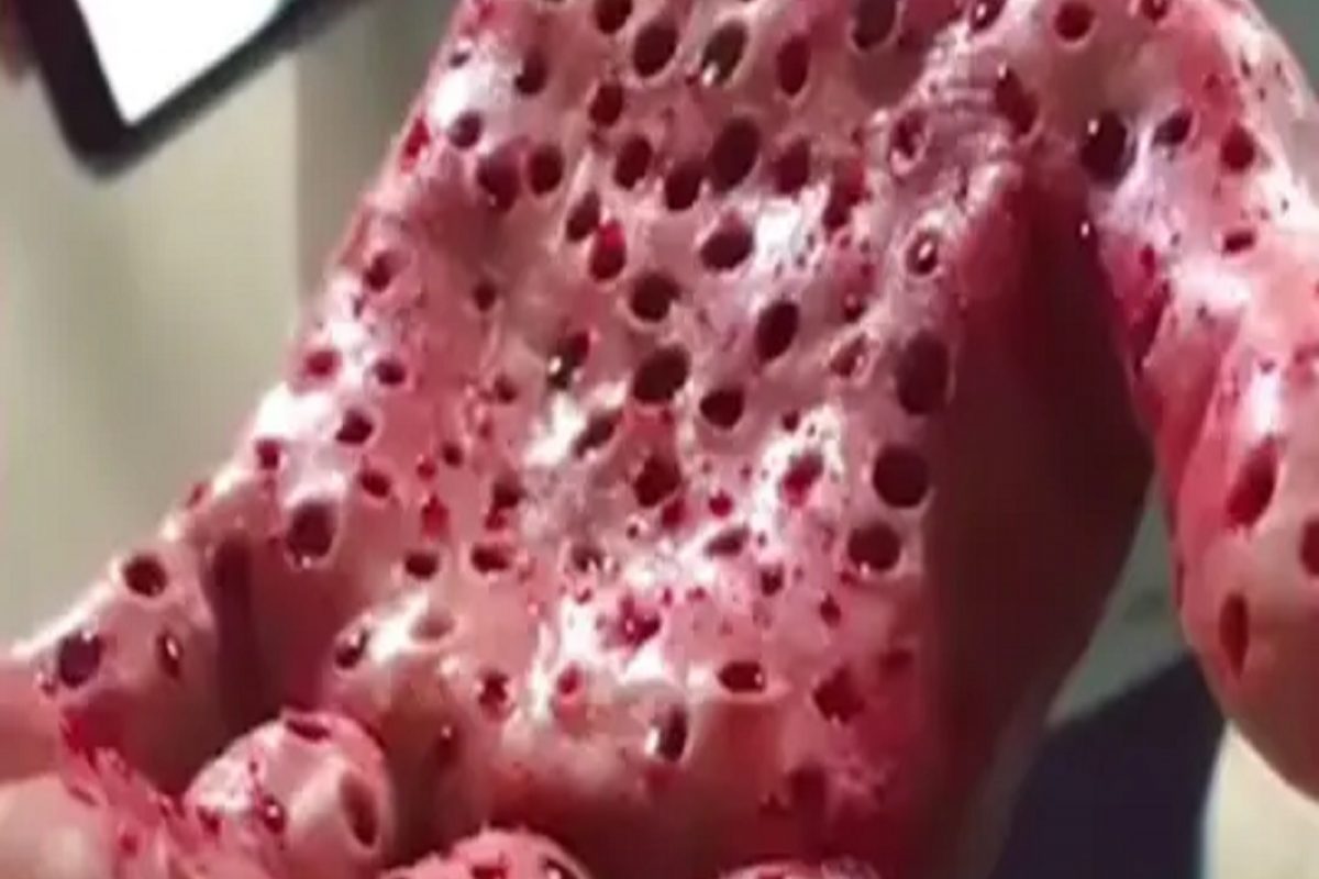 बापरे! हा नवा व्हायरस की आणखी काही? पाहा या छिद्र असलेल्या हातामागील नेमकं सत्य
