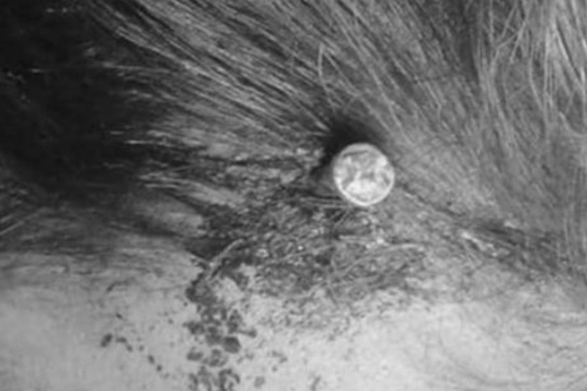 धक्कादायक! गर्भवती महिलेच्या डोक्यात ठोकला 2 इंचाचा खिळा, कारण वाचून उडेल थरकाप