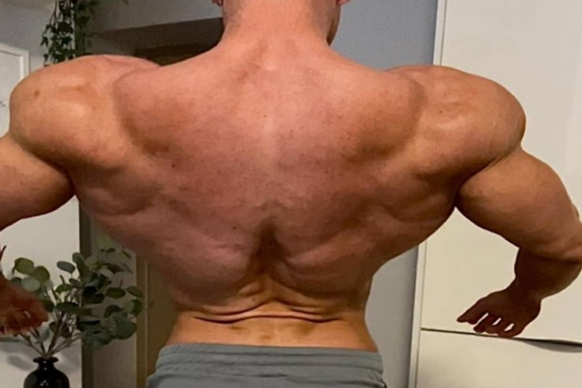 बापरे! छातीऐवजी पाठ आली बाहेर; EXCERCISE चा झाला उलटा परिणाम