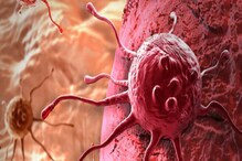 आता घाबरण्याची गरज नाही! फक्त एका बॉलने Cancer क्लीन बोल्ड; 33 दिवसांतच खात्मा