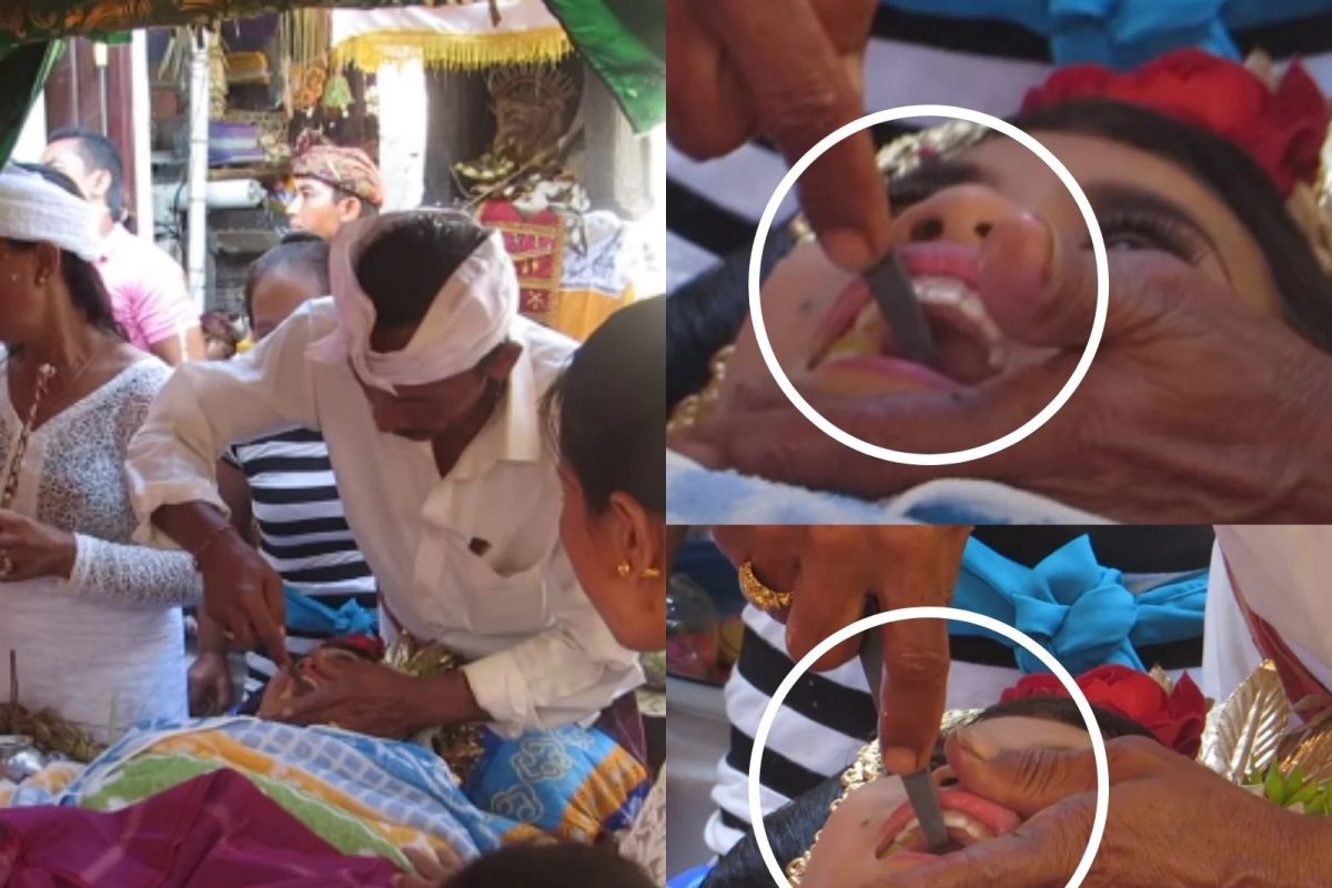 अजबच! या गावात तरुणांचे दात घासून केले जातात सपाट, कारण आहे आणखी Shocking