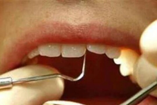 Shocking! 10 वर्षाच्या मुलाच्या जबड्यात होते 50 दात; काढण्यासाठी अडीच तास डॉक्टरांनी केले प्रयत्न अन्...