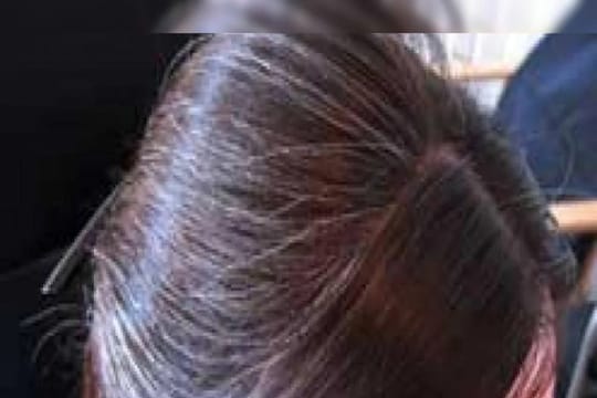 Hair care: पांढऱ्या केसांना फक्त डाय करून भागणार नाही; आहारात हे पदार्थ घेताय का पाहा