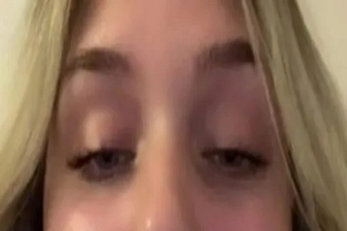 OMG! Beauty treatment चा भयावह परिणाम; सुंदर दिसण्याऐवजी तरुणी बनली 'माकड'