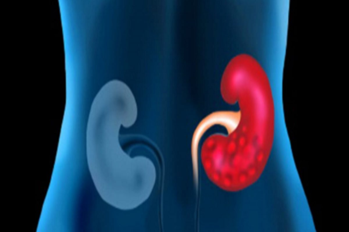 एकदम नॉर्मल वाटणाऱ्या या सवयी किडनी खराब करू शकतात; या चुका अनेकांकडून होतात