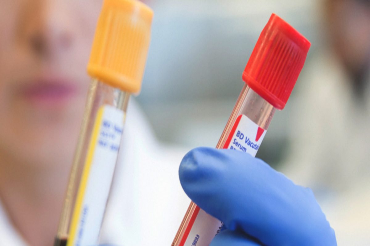 आपला ‘O Blood Group’ आहे असं समजून केलं रक्तदान; मात्र, जगातला दुर्मीळ रक्तगट असल्याचं आलं समोर