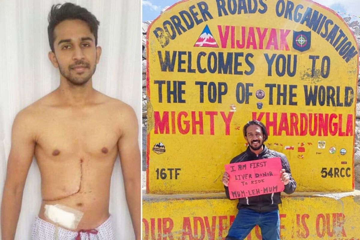 लिव्हर दान केल्यानंतर लोक म्हणायचे तू काहीच करू शकणार नाही! तोच Bike Rider लाखो लोकांना देतोय प्रेरणा