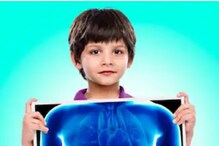 ब्रिटनमध्ये गूढ विषाणूने मुलांमध्ये तीव्र हिपॅटायटीसचा प्रसार झाल्याने खळबळ ब्रिटनमध्ये गूढ विषाणूने मुलांमध्ये तीव्र हिपॅटायटीसचा प्रसार झाल्याने खळबळ