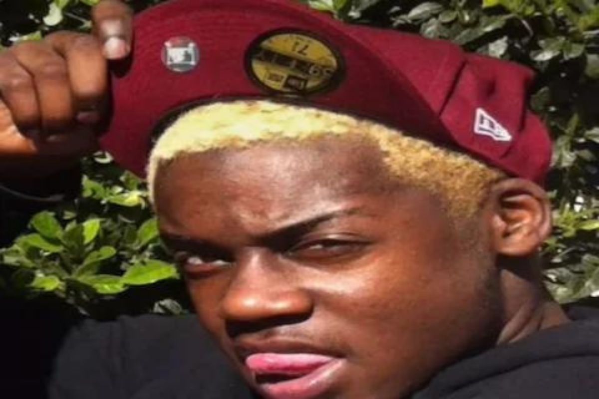 गोरं दिसण्यासाठी दर महिन्याला ब्लीचसाठी खर्च करायचा 20 हजार; 10 वर्षांनंतर झाली भयंकर अवस्था