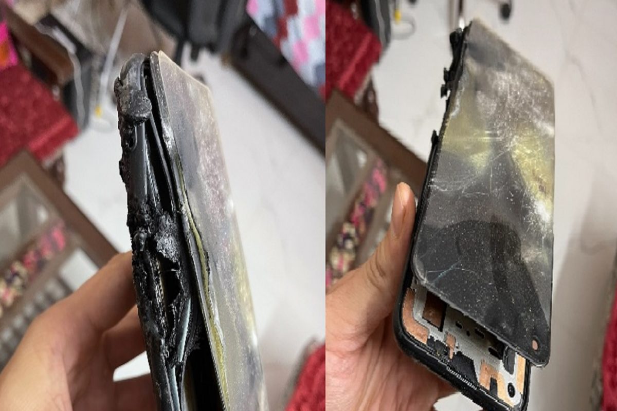 Oneplus Nord 2 मध्ये पुन्हा ब्लास्ट, फोनवर बोलता बोलता झाला स्फोट; यूजर जखमी