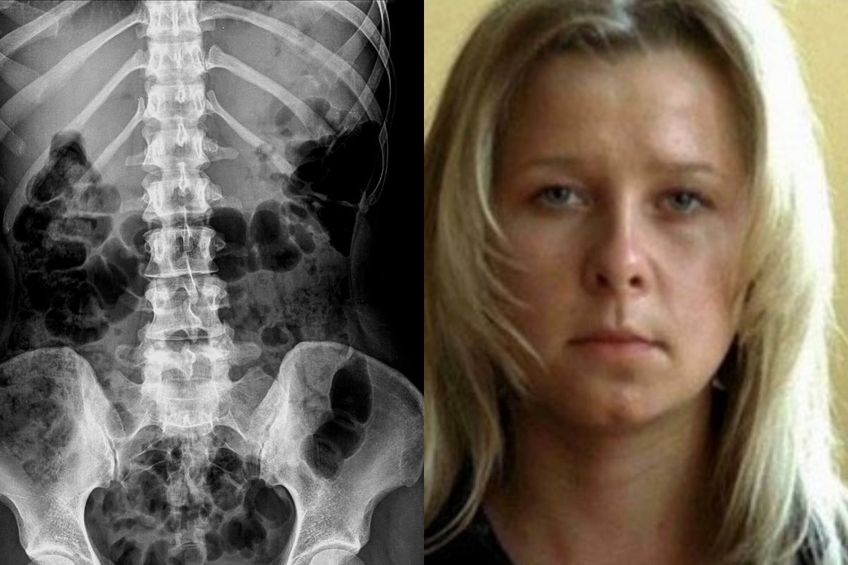 मुलीनं X-Ray प्रमाणे दृष्टी असल्याचा केला होता दावा! समोर आलं धक्कादायक सत्य