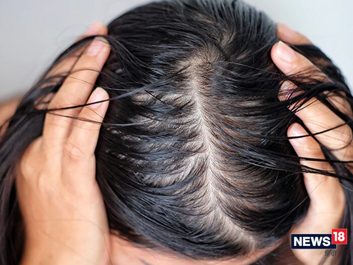 तेलकट केसांपासून सुटका : आपण पाण्यात समुद्री मीठ टाकून, केस धुवून किंवा शॅम्पूमध्ये समुद्री मीठ टाकून तेलकट केसांपासून सुटका मिळवू शकता. वास्तविक, समुद्रातील मीठ डोक्याच्या त्वचेच्या मृत पेशी काढून तेल ग्रंथींचे सीबम उत्पादन कमी करण्यास मदत करते. त्यामुळे केसांवरील अतिरिक्त ऑईल कमी होऊ लागते.