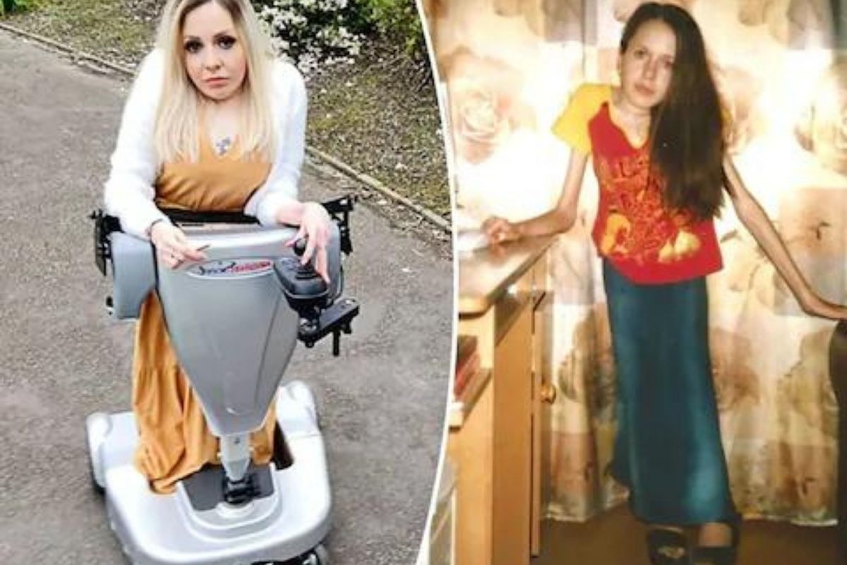 30 वर्षांपासून एकदाही खाली बसू शकलेली नाही महिला; सांगितली स्वतःची वेदनादायी कहाणी