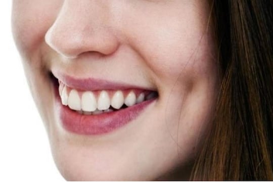 Lucky Girls: खळी पडणाऱ्या मुलींच्याबाबतीत ही गोष्ट असते खास; गाल पाहून पण कळतं बरंच काही
