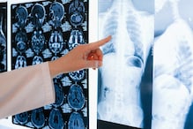 फुप्फुसांचं आरोग्य कसं सांभाळाल? या 5 सोप्या पद्धतींमुळे निरोगी राहाल! फुप्फुसांचं आरोग्य कसं सांभाळाल? या 5 सोप्या पद्धतींमुळे निरोगी राहाल!