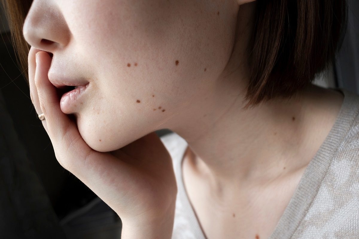 चेहऱ्याच्या या भागांवर तीळ असणं मानलं जातं शुभ; तिळावरून असं कळतं एखाद्याचं व्यक्तिमत्व