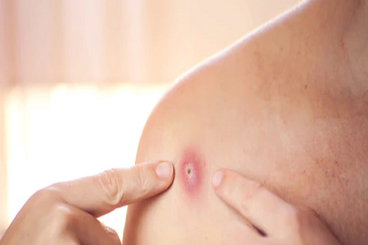 प्रतीकात्मक फोटो (सौजन्य - Shutterstock)